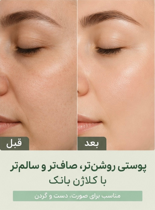 کرم بانک کلاژن کلامین